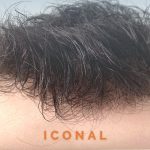 ICONAL Toupet en mono fin soudé avec densité 70% pour hommes | New Times Hair