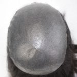 Toupet sur mesure en peau normale injectée (plate injectée) pour femmes | New Times Hair