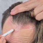 Tutoriel d'installation et de coiffure de postiche frontal